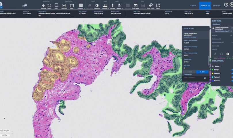 Qritive Joins Forces with Roche to Redefine Global Cancer Diagnostics with AI