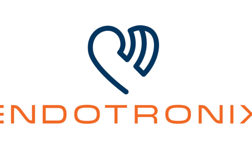 ONE-YEAR DATA SHOW EXCELLENT OUTCOMES FOR ENDOTRONIX CORDELLA PULMONARY ARTERY SENSOR SYSTEM ONE-YEAR DATA SHOW EXCELLENT OUTCOMES FOR ENDOTRONIX CORDELLA PULMONARY ARTERY SENSOR SYSTEM