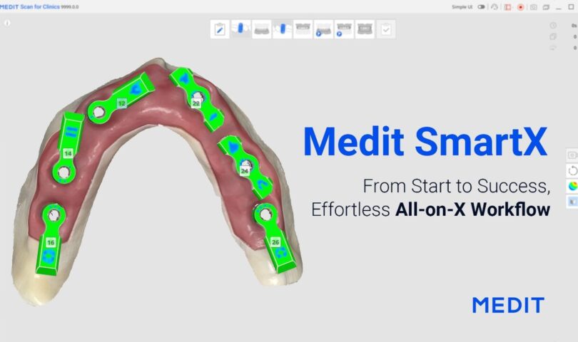 Medits bahnbrechender Workflow steht kurz vor der Einführung